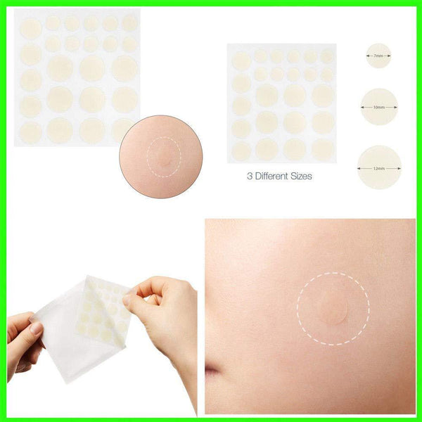 24pcs Hydrocolloid Acne Invisible Pimple Master Patch Skin Tag Removal Patch Pimple Blackhead Blemish Removers Facial Care Tool
