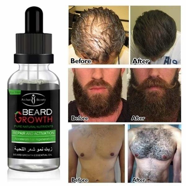 30ml Beard Growth Oil